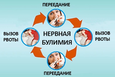 Лечение булимии в Прокопьевске